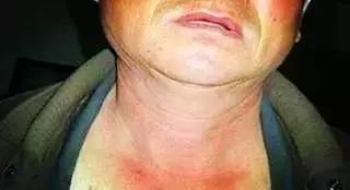 刚吃半个，男子竟差点送命！这种水果正大量上市，很多人爱吃！