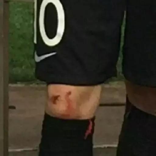 卡拉斯科球迷哭了,卡拉斯科被暴打