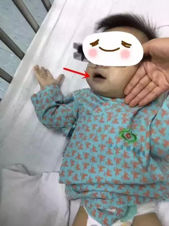 母亲信偏方喂孩子吃活蝌蚪,信偏方的后果