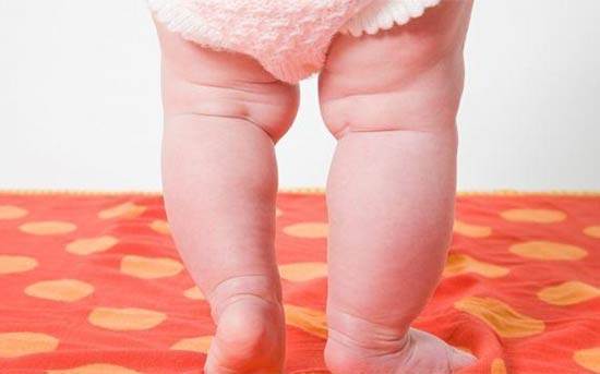 宝宝的脚变成了罗圈腿,导致宝宝罗圈腿的真正原因