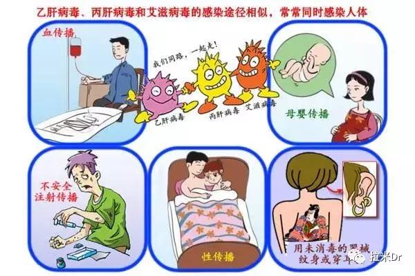 hiv病毒携带者就会患丙肝吗,hiv感染者一定会发烧吗