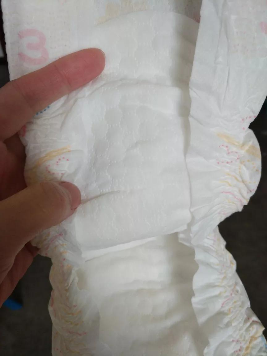 宝宝红屁屁和屁股湿疹区别,宝宝起湿疹跟纸尿裤有关系么