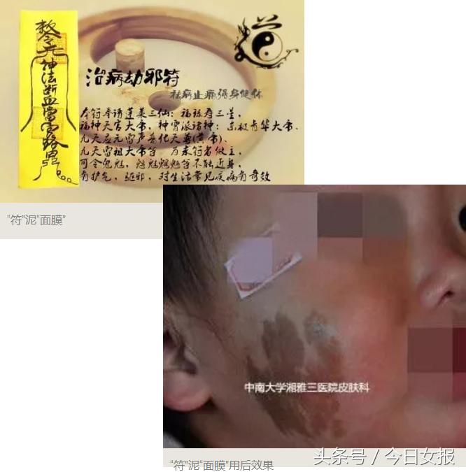 吃了活蝌蚪会怎样,喂孩子吃活蝌蚪能治病