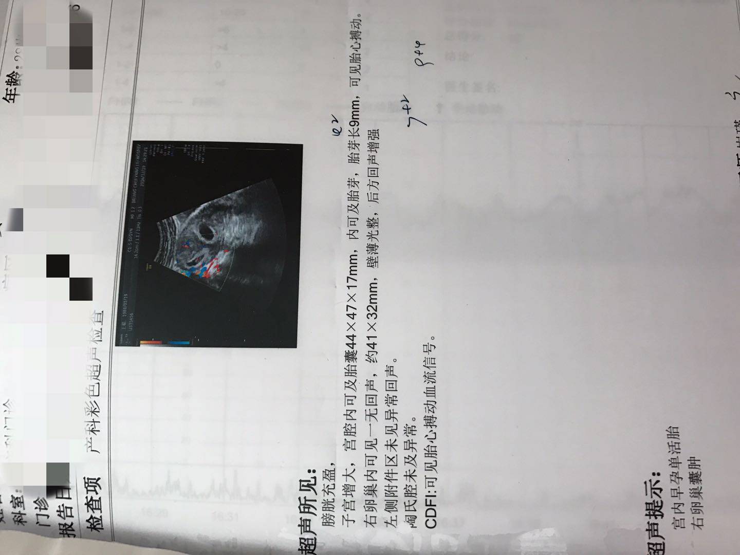 绮変笣绾︾,瀛曞绮変笣鎶曠