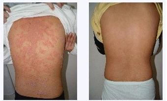 美乐家茶树精油功效,薰衣草茶树精油的功效与作用