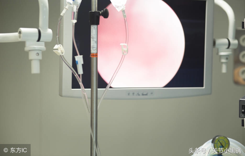 关节镜微创手术适应症有哪些,微创手术和关节镜有什么区别