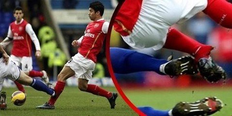 足球被爆头,足球守门员被爆头