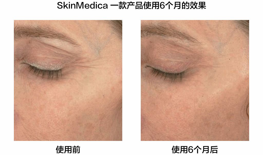 牛过微整术！神奇EGF究竟多逆天？