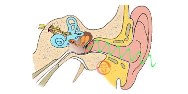 颅内胆脂瘤该怎么治疗,先天性颅内胆脂瘤术后