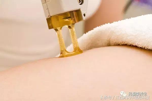 脱毛小技巧亲测有效,脱毛全攻略不再毛手毛脚