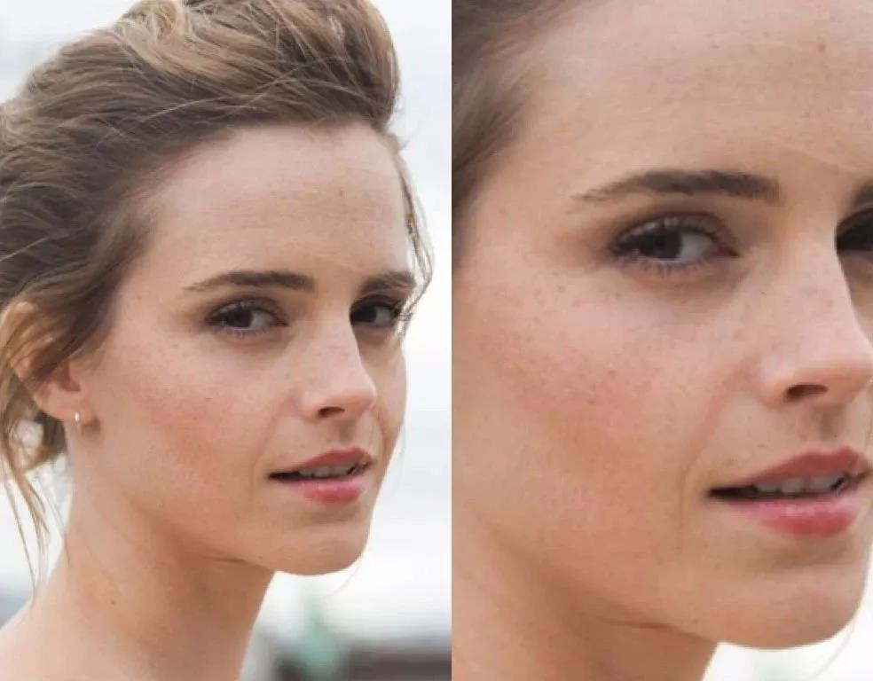 艾玛沃森的颜值变化,艾玛沃森素颜雀斑脸
