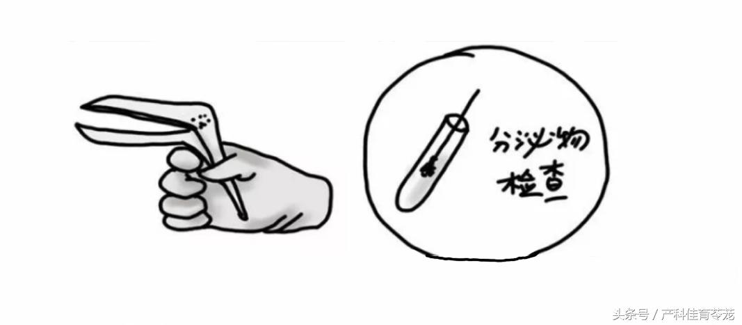 leep冷刀锥切全过程,冷刀锥切和LEEP刀哪个恢复快