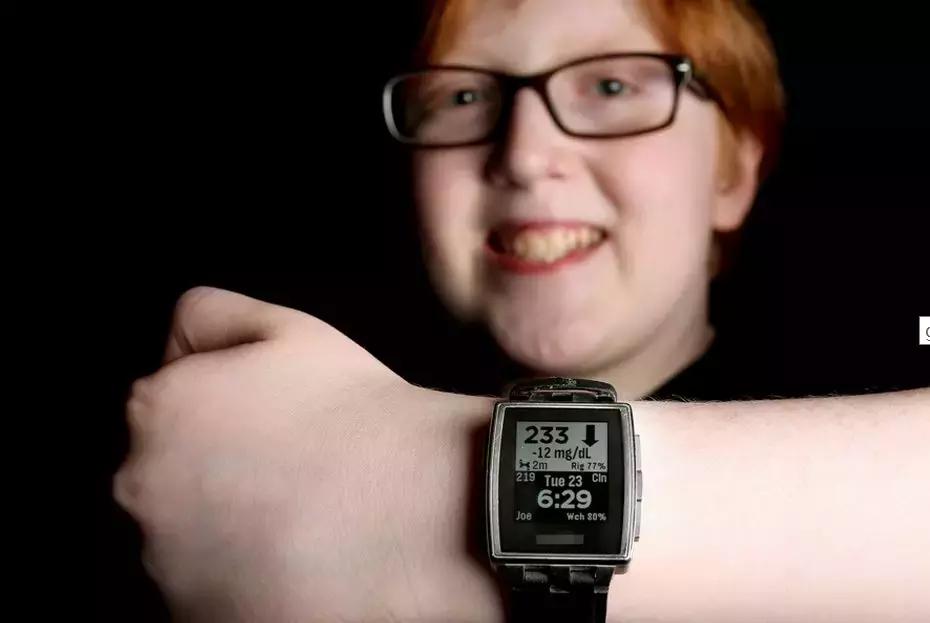 糖尿病先进技术与治疗,糖尿病最新科学技术