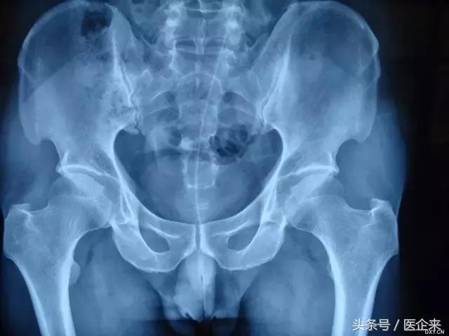 不可思议奇怪的东西,不可思议小物件穿透