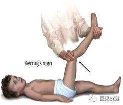 发热与热性惊厥，爸妈的盲点和难点详解，让您不做发热恐惧症父母