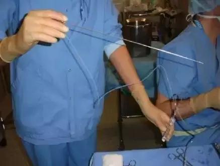 女大学生捐卵案完整,女大学生捐29个卵