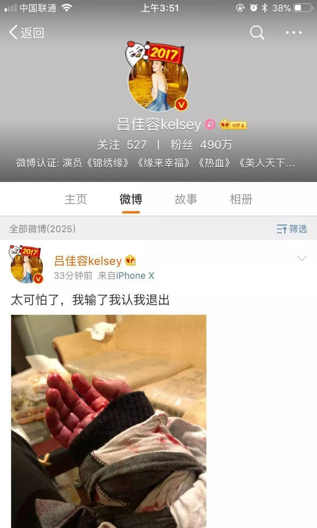 娱乐圈*规则潜**有多可怕女星割腕称自己是下一个乔任梁