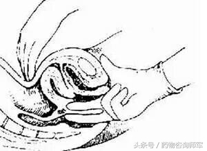 女性妇科检查可以查出有几个男人,35岁女性每隔多久做一次妇科检查