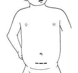 灯泡进肛门引发万人关注，“会诊”结果靠谱么？