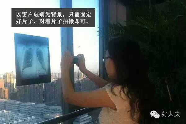 家里怎么拍片子给医生,如何把拍的ct片发给医生