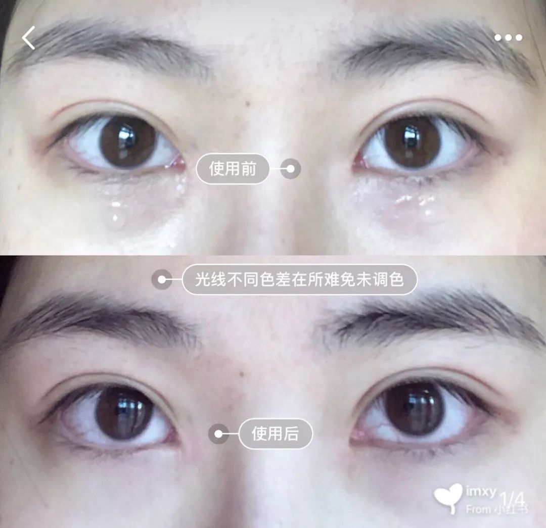 眼霜种草好物推荐去细纹,好物分享超级好用的眼霜