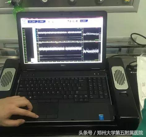 郑州大学第一附属医院治疗帕金森,郑州大学五附院脑梗康复治疗