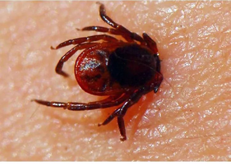蜱虫常见的3个地方及解决技巧,蜱虫怎么预防出现在人身上