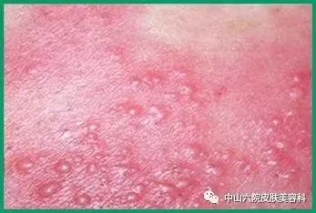 总有人觉得你腰缠万贯,总有人认为你腰缠万贯