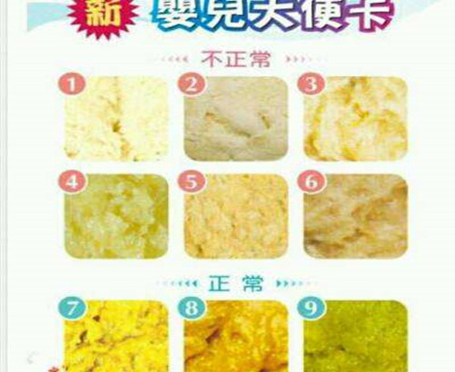 新生儿大便怎么是正常,新生儿宝宝大便绿色是什么原因