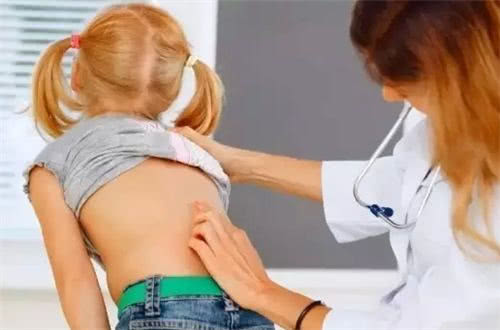 两岁多的孩子驼背,宝宝两岁半驼背