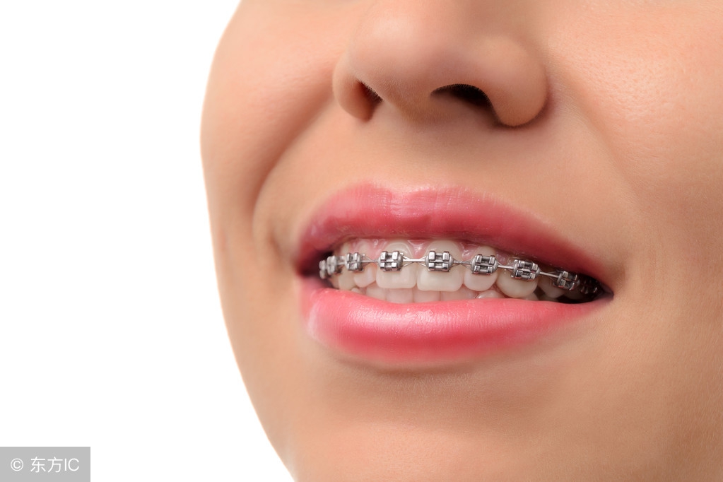 矫正牙齿可以变美吗,矫正牙齿后变美更自信