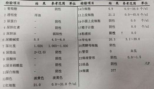 宝宝查出重复肾需要手术吗,儿童胡桃夹血尿自愈经历