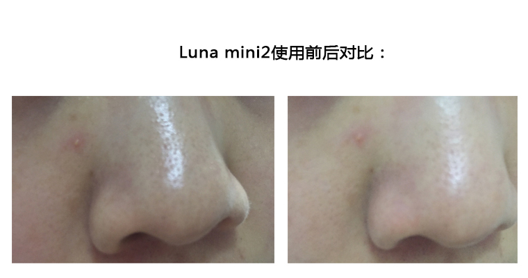 周冬雨小周迅,周冬雨小珍珠脸