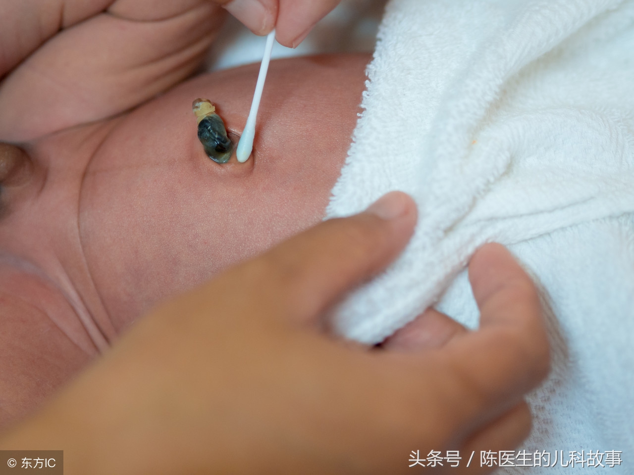 育婴师新生儿脐部护理实操,新生儿脐部护理的图片