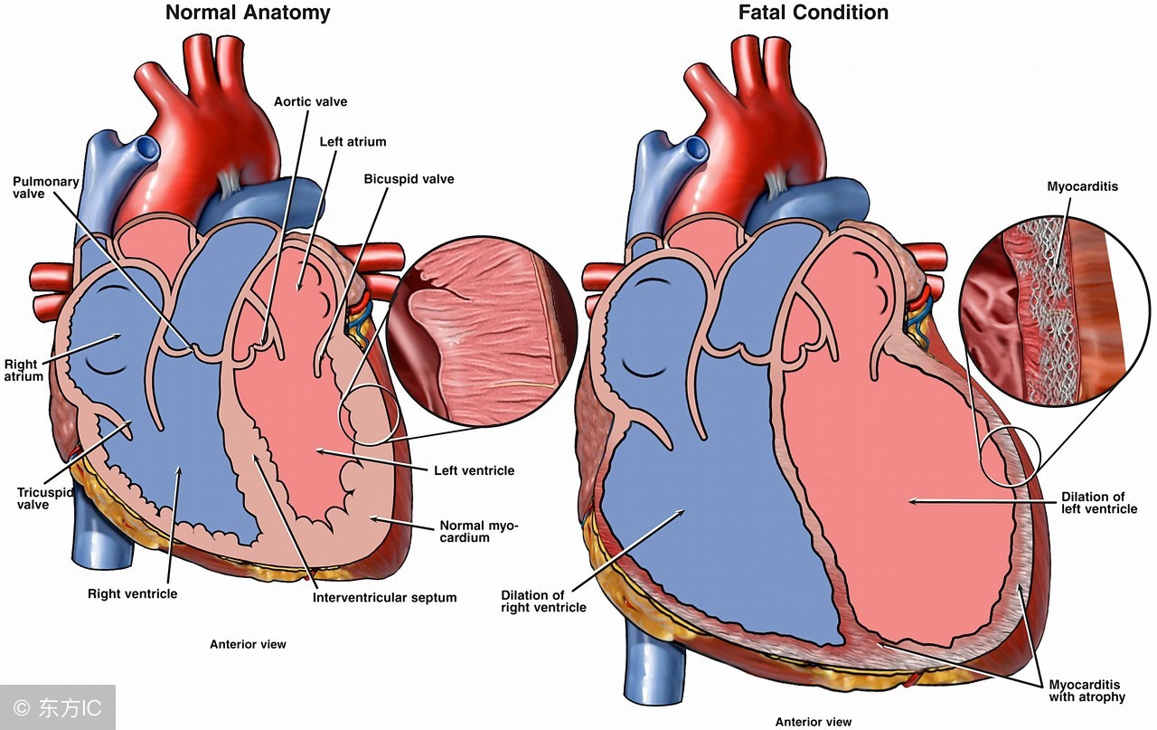 非感染性心肌炎的病因有,诱发心肌炎常见病因