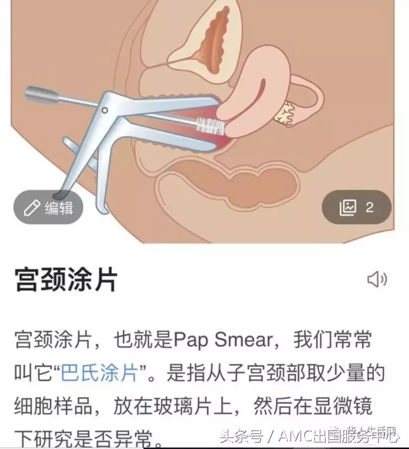 南加大女学生性侵案,美国南加大校医性侵案和解