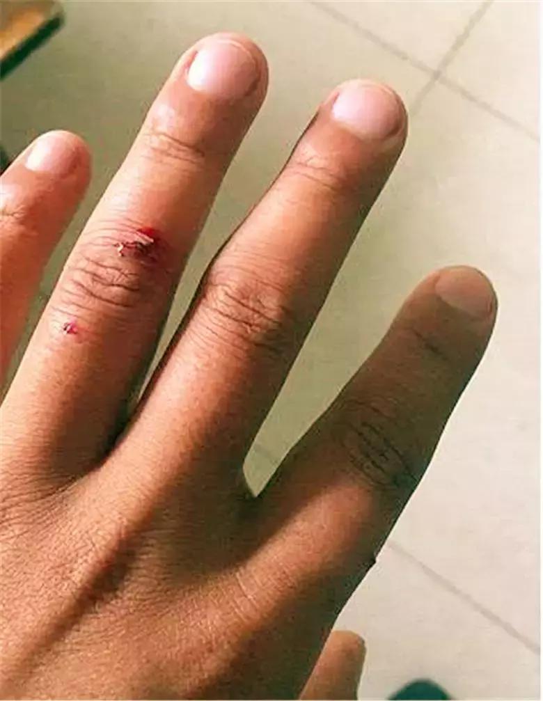 土狗看家如何不被咬,小土狗护食被咬