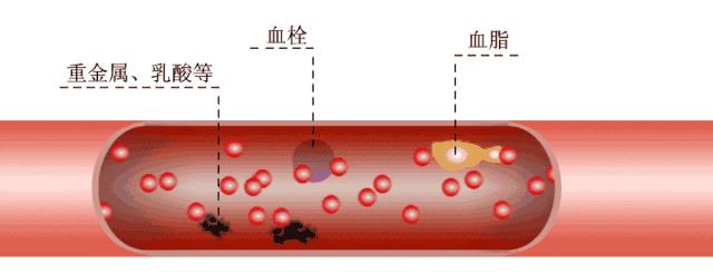 人的血管怎么清洗,为什么保养血管很重要