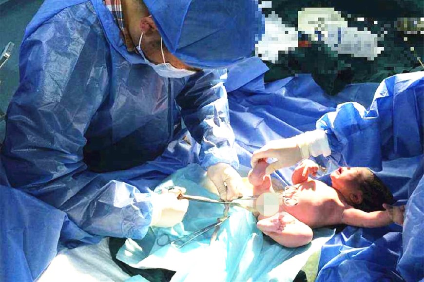 医生剪断脐带,新生儿剪断脐带