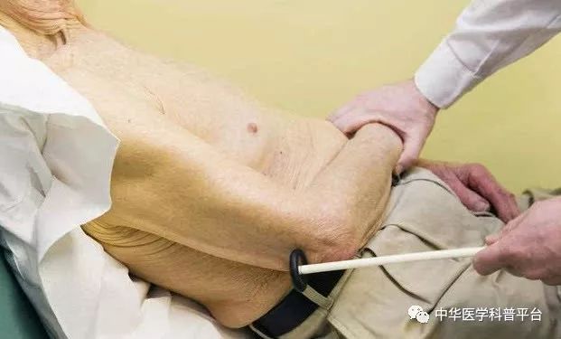 下身浮肿是什么原因,腿子浮肿是什么原因