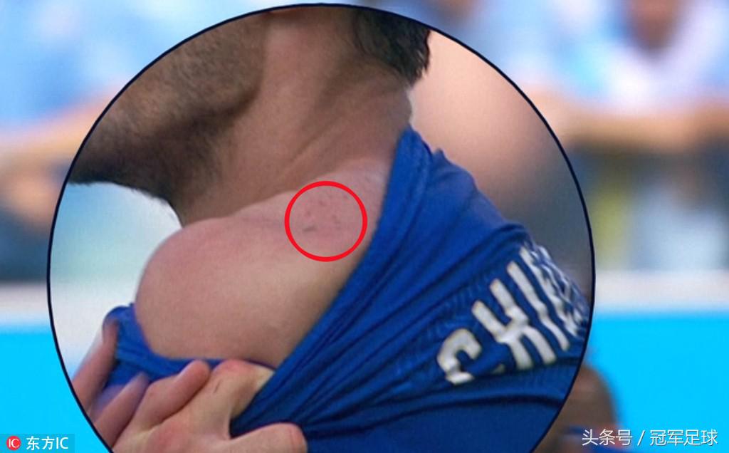 天才在左疯子在右讲的是什么故事,苏亚雷斯世界杯梅开二度