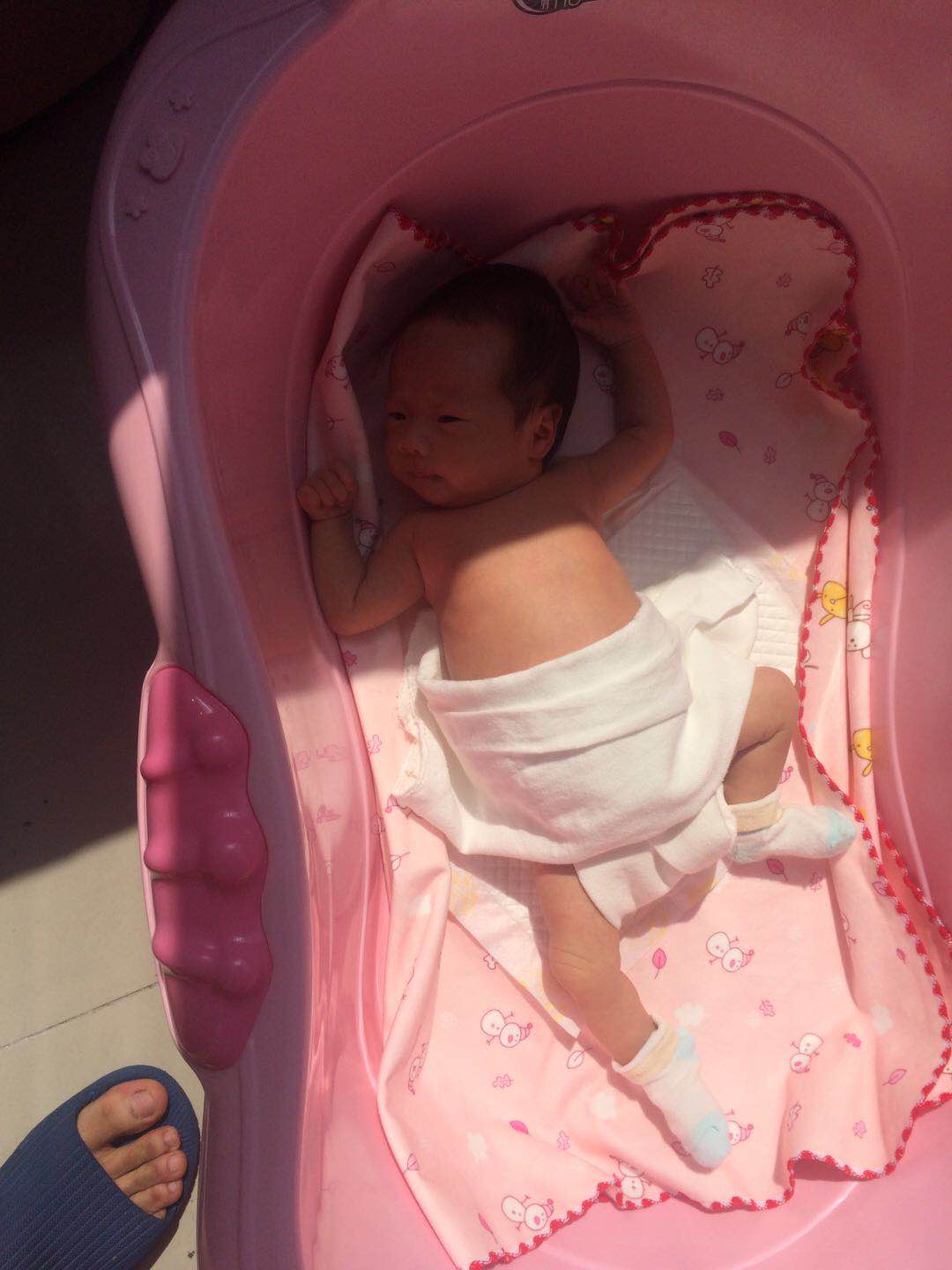 新生儿黄疸应怎么办,新生儿黄疸治不好怎么办