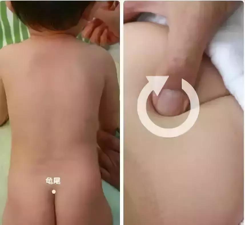 小孩怎么可以改善便秘,宝宝便秘用五种方法治疗便秘