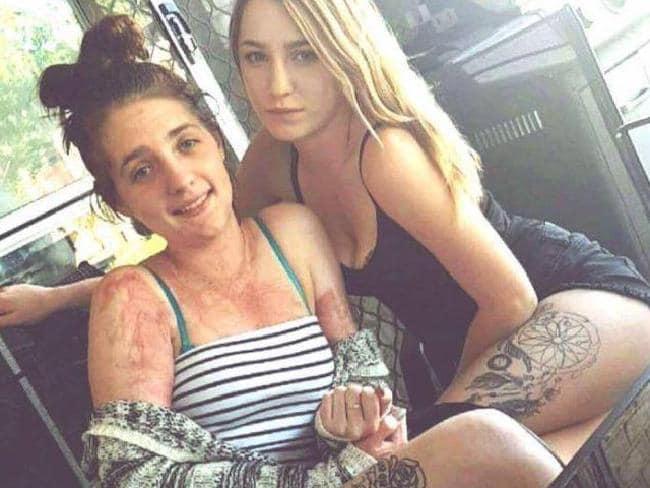 交友不慎！澳大利亚少女惨遭渣男泼汽油惨变“火球”