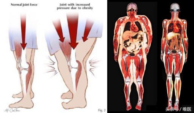 膝盖长期痛怎么办,膝盖痛有什么好方法治疗