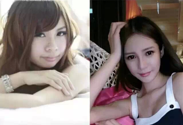 你如何看待整形手术后果,你对整形这件事情怎么看