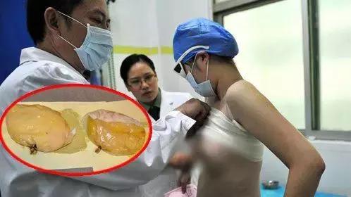 可笑又可怕，为了运毒，他们连小丁丁都不放过