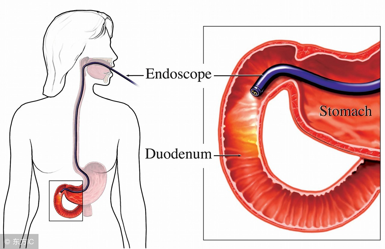 检查肠梗阻需要灌肠吗,检查是不是肠梗阻做什么检查