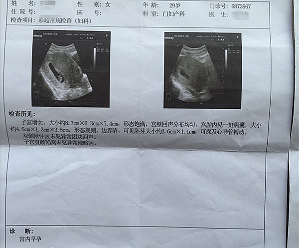 怀孕空腹喝豆浆就吐,怀孕空腹喝豆浆吐