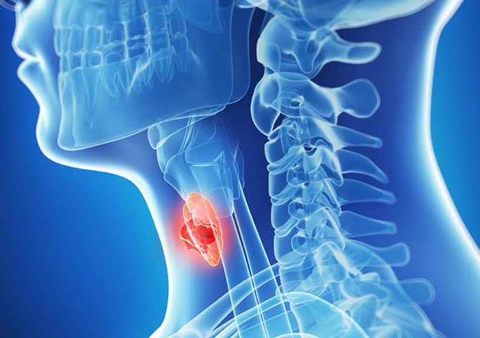 喉癌明显症状是耳朵痛吗,总是耳朵疼一查是喉癌